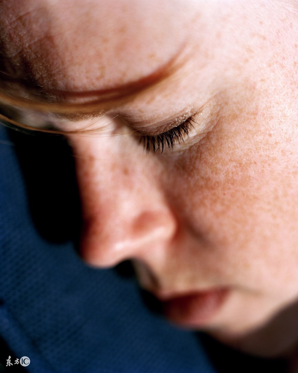 男性遗传雀斑如何避免遗传下一代,爸爸雀斑会遗传给女儿吗如何避免