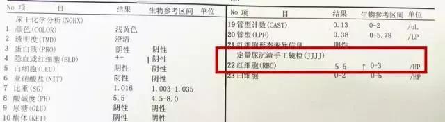只有血尿，IgA肾友怎么管理病情？