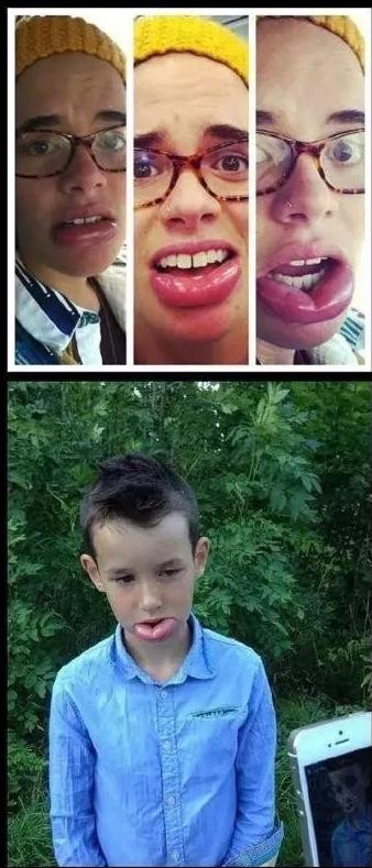 哈哈哈，原谅我拖拉机般的笑声！当喵星人被蜜蜂蜇了之后