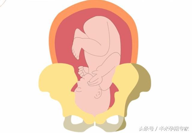 怎么理解胎儿入盆和开宫口