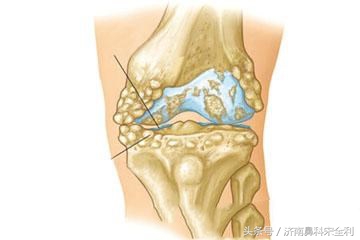三甲医院通用的《疾病先兆自查表》,我用了几十年,现在还在用!