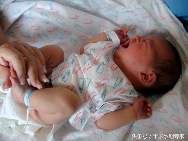 新生儿湿疹与皮疹,怎么区别是尿布疹还是湿疹