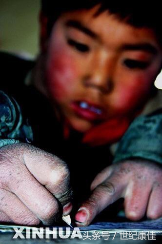 七草缘皮肤教学视频,七草缘中药