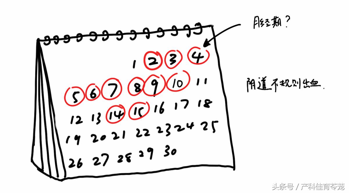 子宫腔长了息肉，哪些情况需要手术