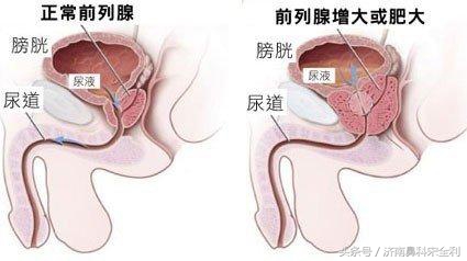 三甲医院通用的《疾病先兆自查表》,我用了几十年,现在还在用!