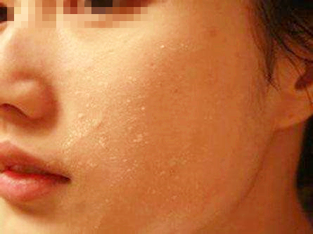 宝宝手起倒刺只需2步快速解决,6个月宝宝手长倒刺怎么办