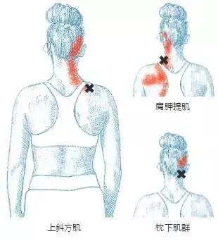 这些放松方法，可以让你舒舒服服渡过“肌肉关”