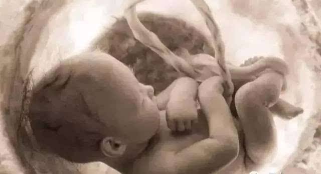 胎儿绕脐一周可以顺产吗,宝宝绕脐纠正姿势