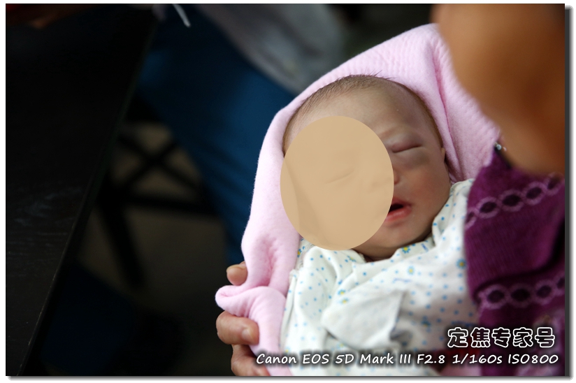 头皮一块一块的红斑,头皮癣治疗要多少钱