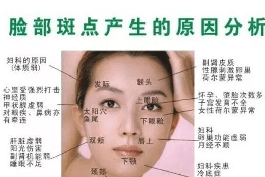 你脸上的斑代表什么含义,脸上开始长斑的原因是什么