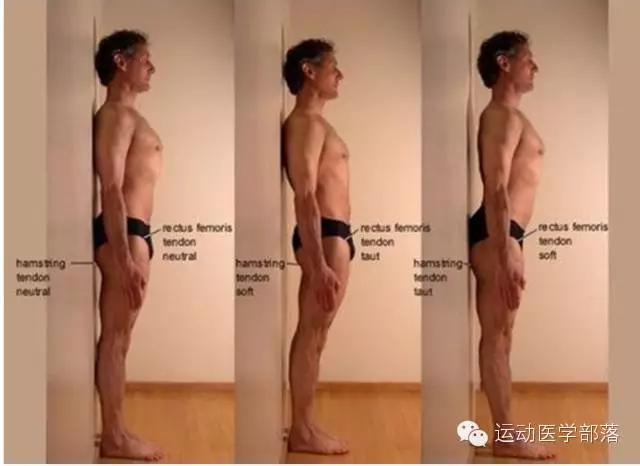 骨盆前移前倾后倾,骨盆前倾与后倾的区别瑜伽视频