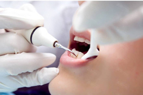 有牙根不拔可以镶牙吗,不取牙根可以镶牙吗