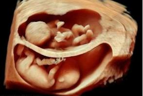 惊！宝妈这些技巧怀上“双胞胎”分享给大家