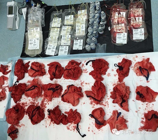 惊心动魄命悬一线,惊心动魄全面反击