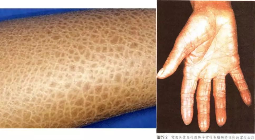 3步搞定冬天各种皮肤问题,冷黄皮保养皮肤