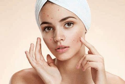 激素依赖性皮炎反复出疹子怎么办,激素依赖性皮炎抹薇诺娜起疹子