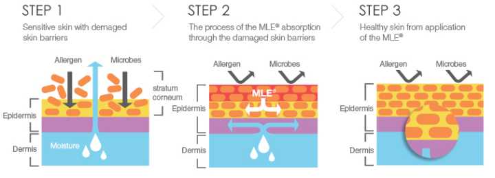 如何解决敏感肌,毛孔粗大敏感肌怎么解决