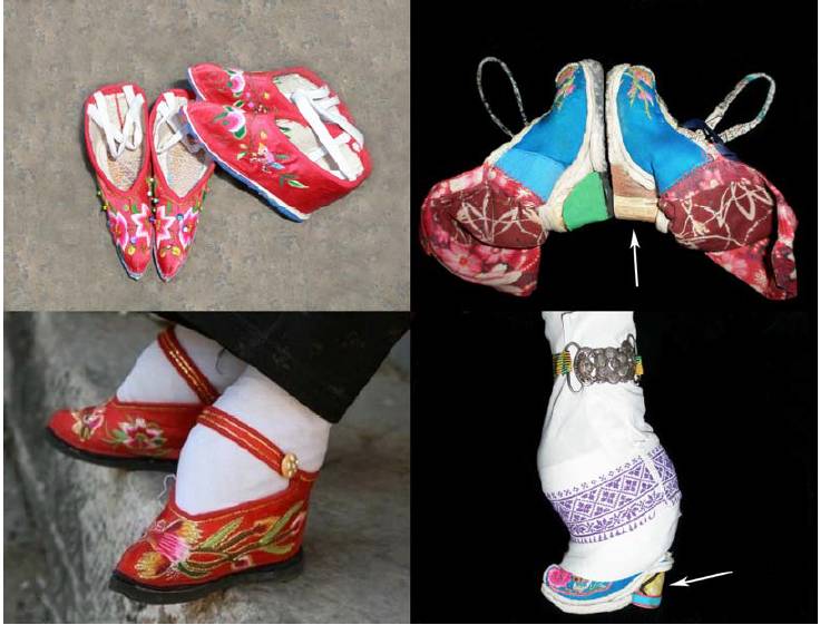 裹小脚的故事,最近的裹小脚事件