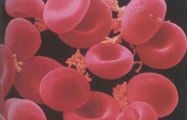 十斤红糖不如一口铁元,拯救黄脸婆全靠它了