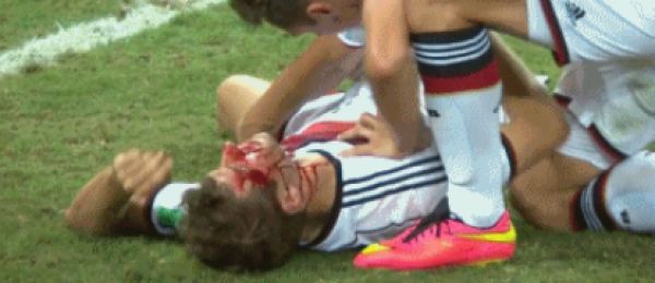 经常撞头会不会影响智商,经常顶号有风险吗