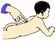 小儿肺炎发烧推拿手法,武汉极鹤小儿推拿