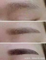 南阳时光微整形,南阳时光整形好还是天后整好