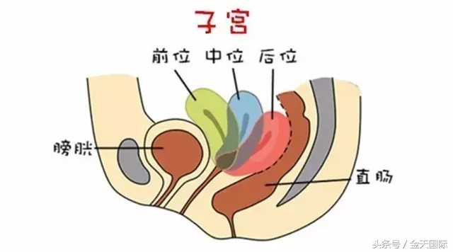 怎么会导致子宫移位的,子宫移位是怎么造成的