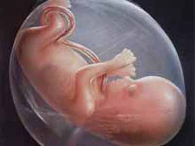 羊水过少导致早产,羊水过少导致缺氧