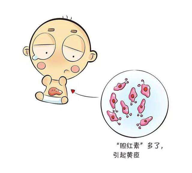 宝宝黄疸的护理方法,宝宝黄疸的几个护理技巧