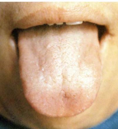 蒲辅周讲舌诊,蒲辅周怎么看舌诊