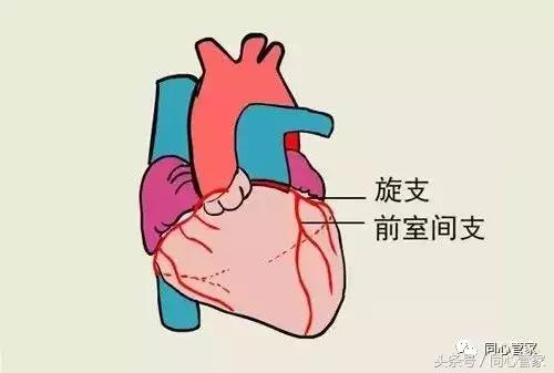 不做支架不搭桥中医调理冠心病,冠心病支架和搭桥的条件