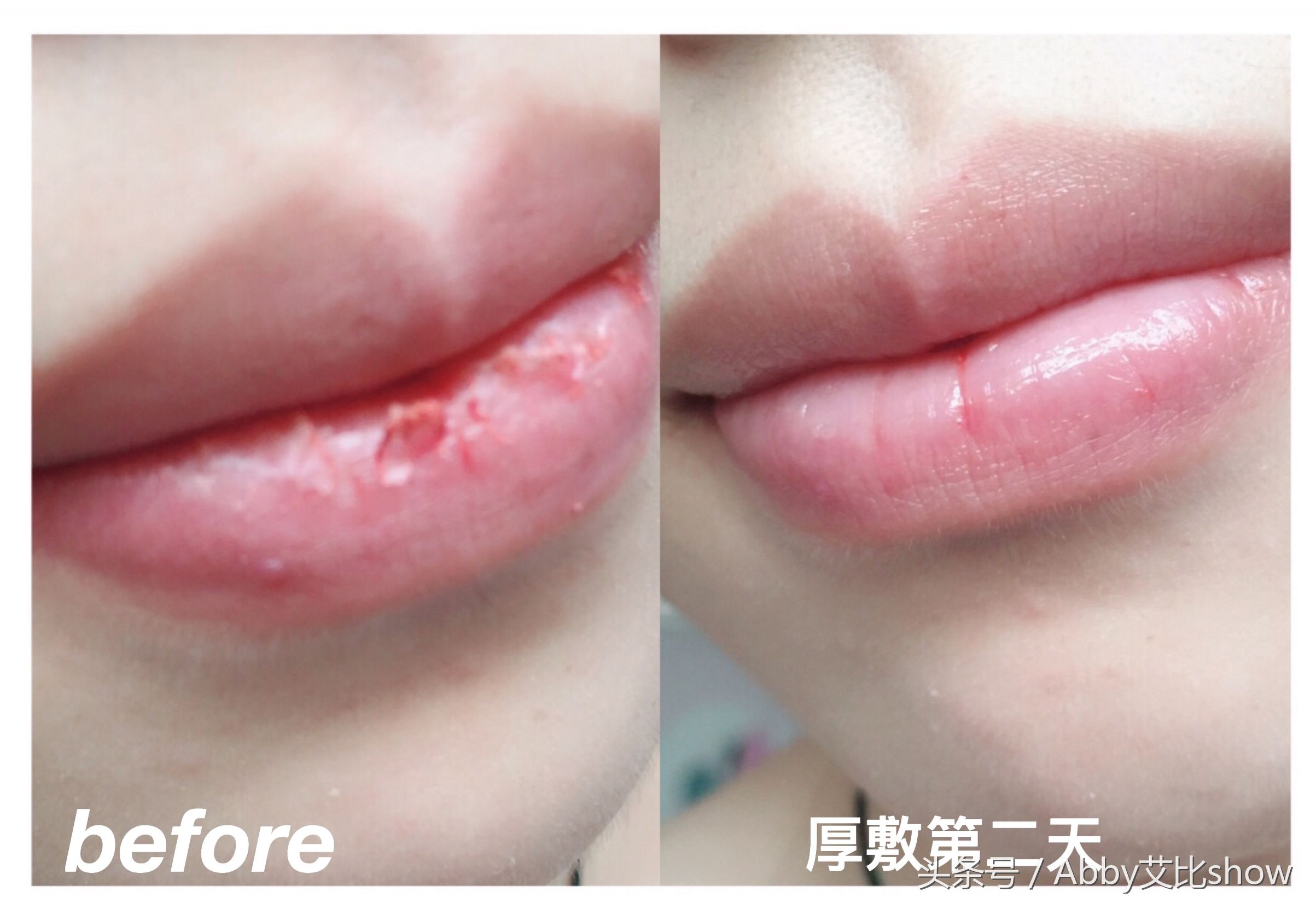 保湿效果特别好的护唇膏,冬季护唇指南养出少女嘟嘟唇