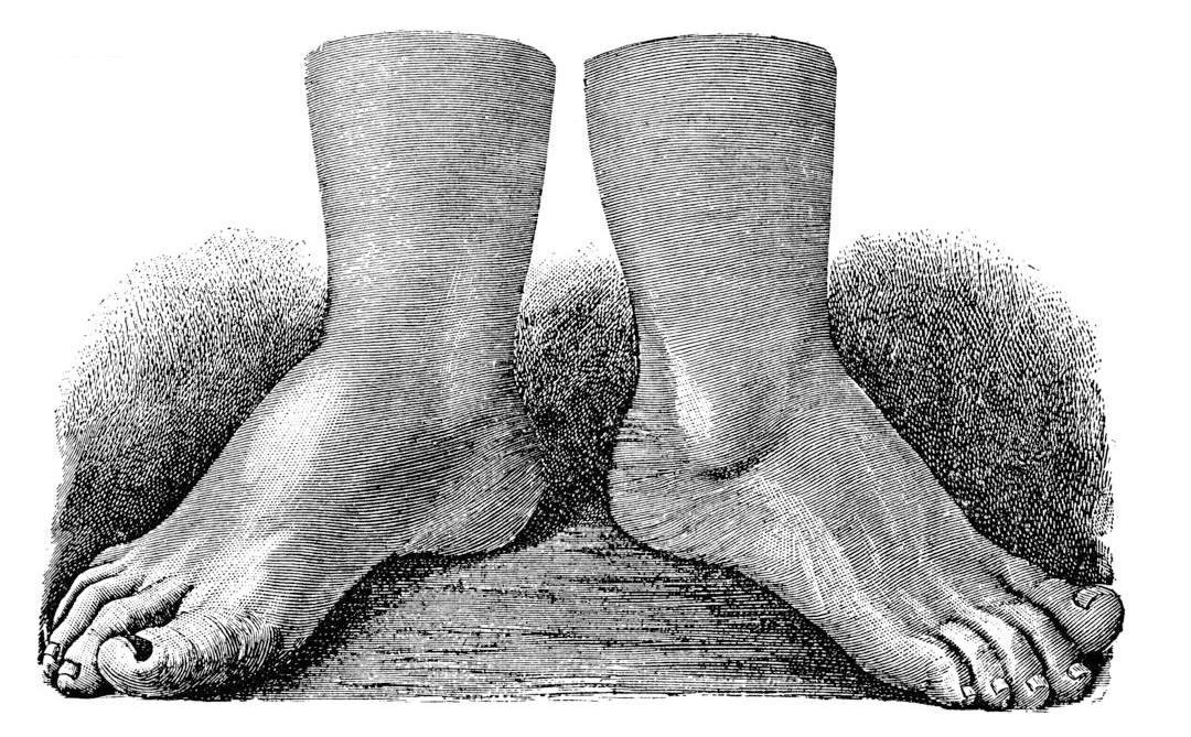 奥运会运动员扭伤用药,奥运会运动员康复训练