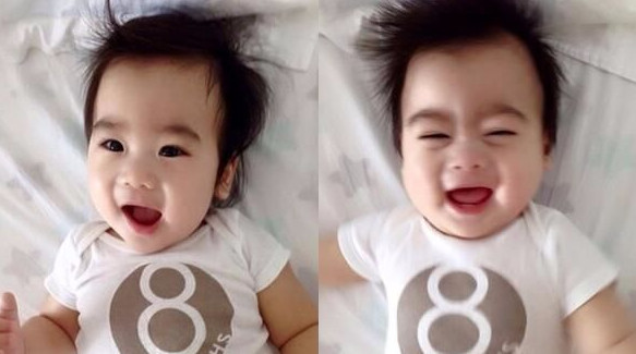 婴儿枕秃是缺钙吗很多家长都错了,宝宝有枕秃就一定是缺钙引起的么