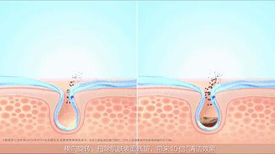 热门的美容仪真的好用吗,大几千的爆款美容仪真的值得吗