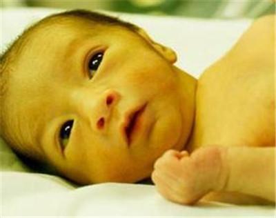 宝宝黄疸高怎么可以让黄疸退下来,宝宝黄疸偏高宝妈吃什么可以缓解