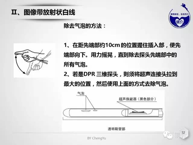 内镜超声小探头设定、使用、维护要点分析