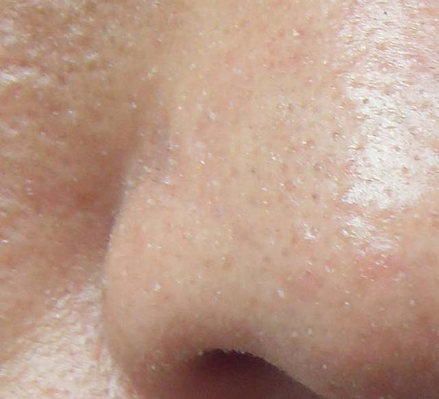 补水控油最有效 (补水控油的最佳方法)