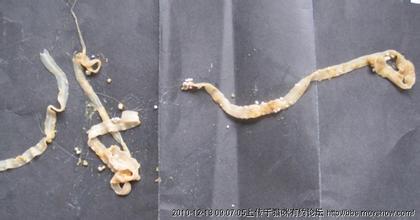 宝宝吃了有寄生虫的东西怎么办,宝宝吃到蔬菜里的虫卵