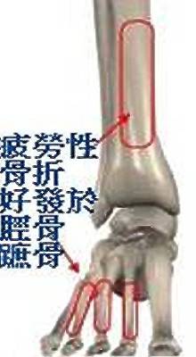 跑步有没有什么伤害,跑步如何减少身体的损伤