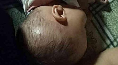 一岁半的宝宝摔下床摔到头了,一岁宝宝掉下床额头摔了个大包