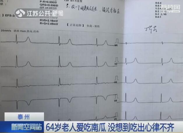 64岁老人爱吃南瓜没想到吃出心律不齐