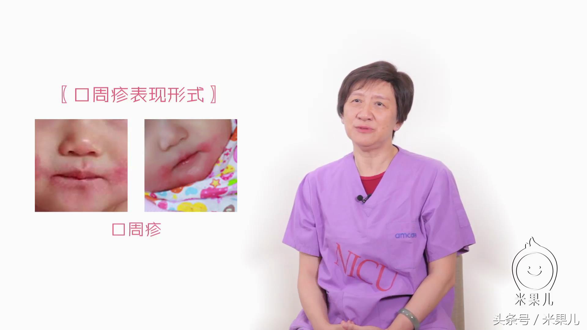 宝宝身上出现疹子该如何处理,如何分辨宝宝身上的疹子