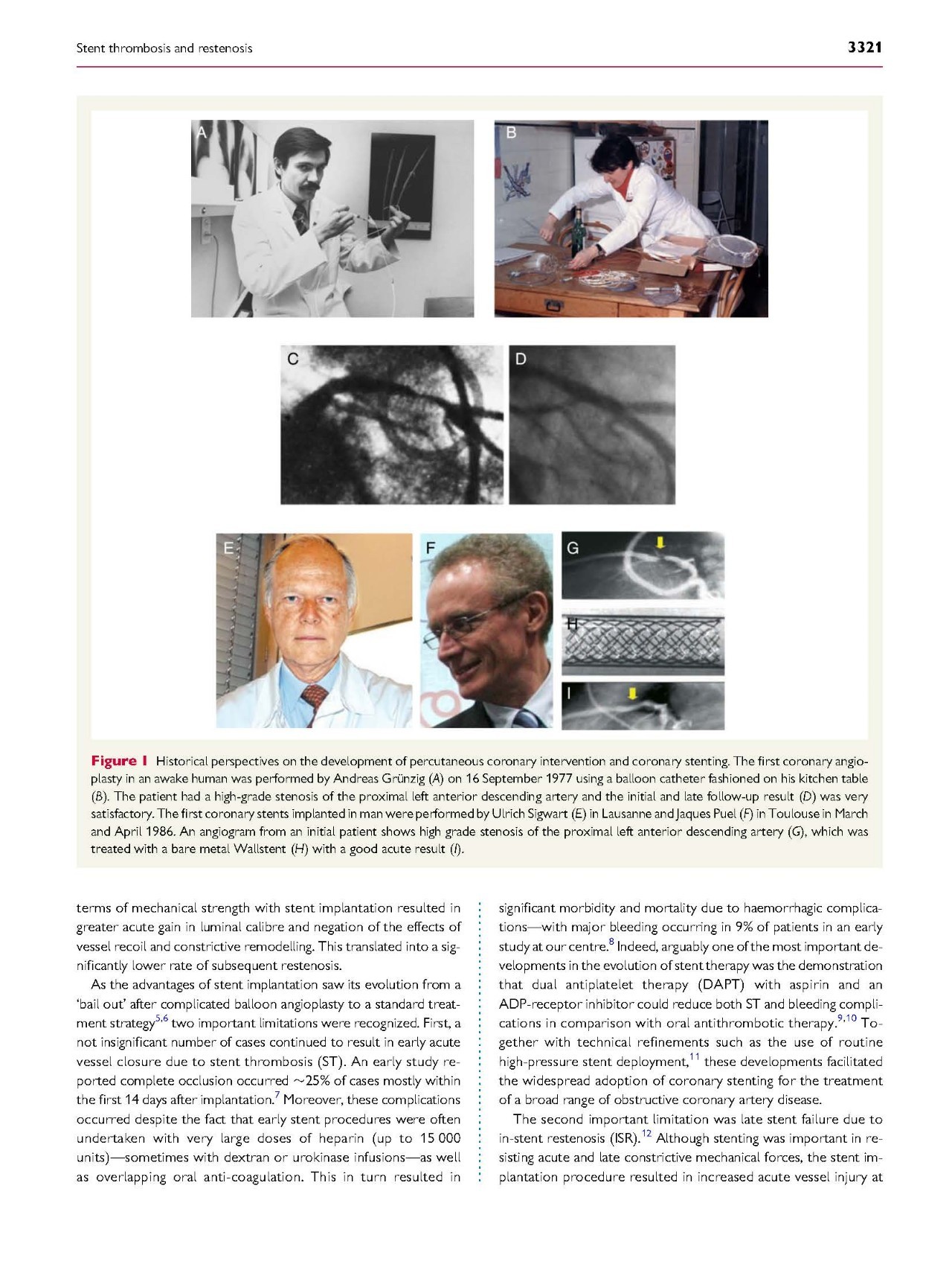 支架内血栓怎么处理,支架内血栓的原因及表现