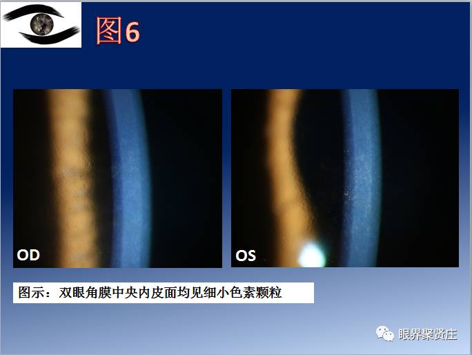 几种眼病的视野图,看图识病是什么病