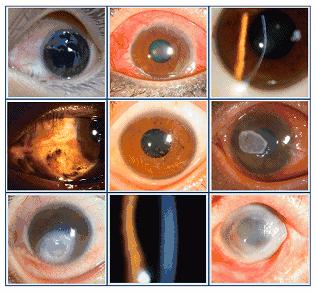 几种眼病的视野图,看图识病是什么病