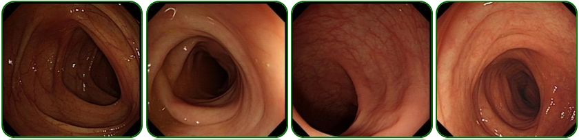 同为同龄人命运各不同,同为双胞胎命运却不同