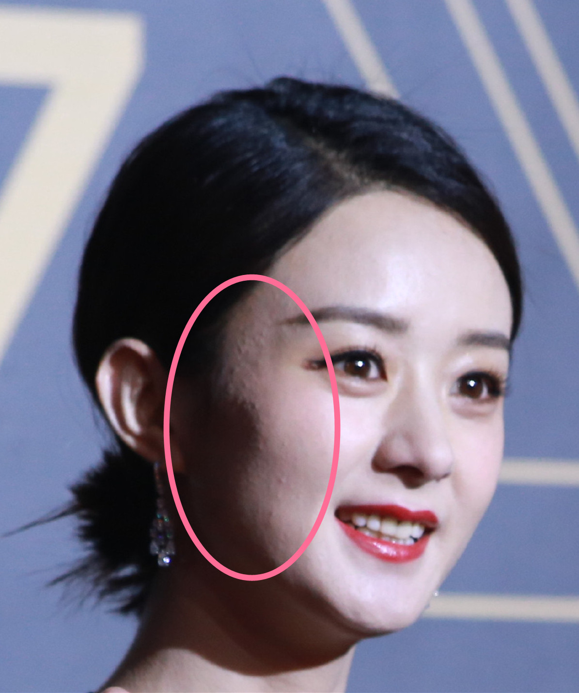 明星生图皮肤质感,明星皱纹变化图片女