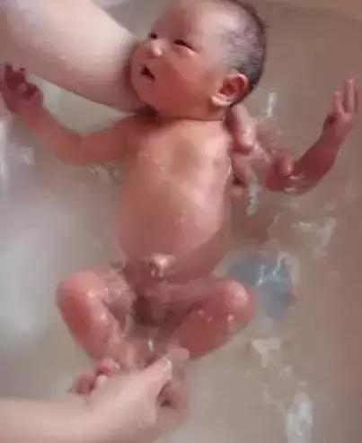 新生儿肚脐5个异常要注意！这篇宝宝脐部护理攻略送给月嫂！