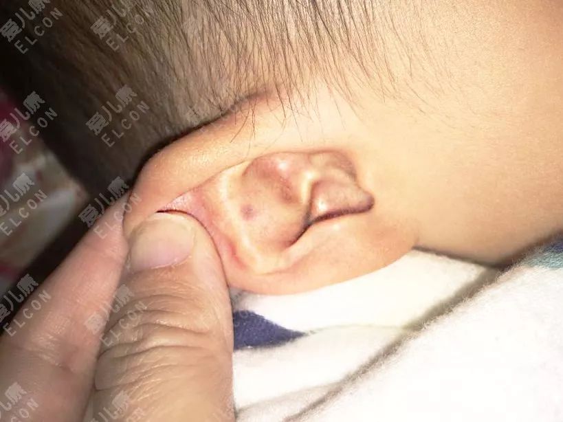 小孩只有尿频一个症状正常吗,一周岁宝宝尿频自愈方法